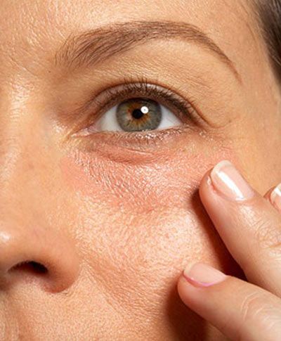 Treatments for looking tired in Sydney at INJXU Cosmetics